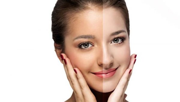 Natural Remedies To Treat Tanning